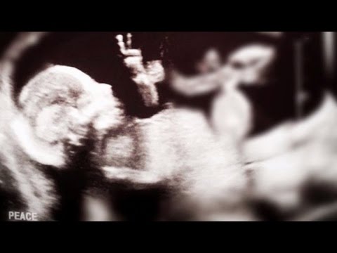Baby in the womb has a message episode artwork